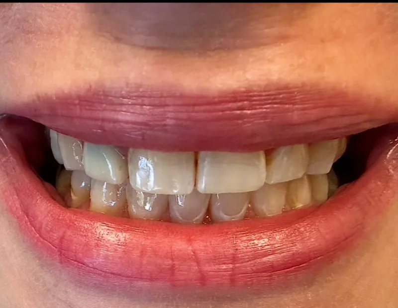 Before image