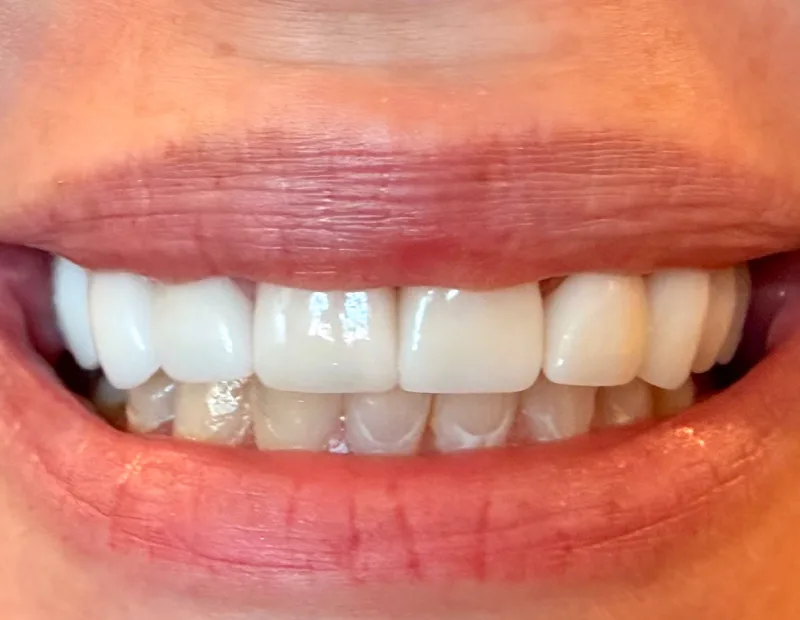 After image