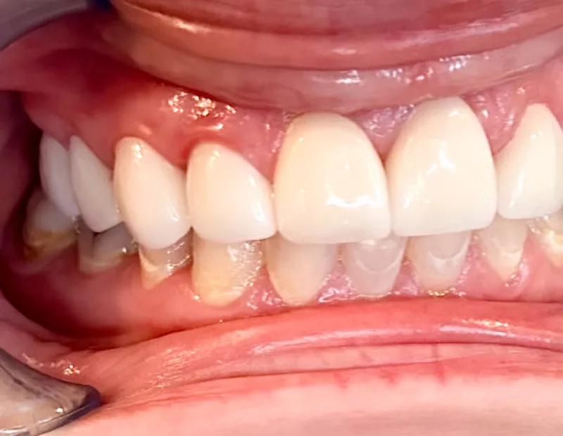 After image