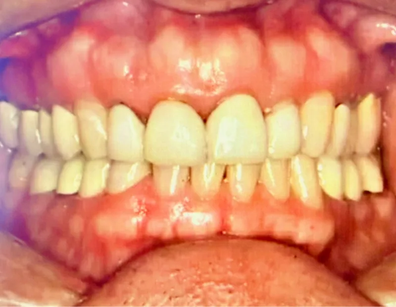 Before image