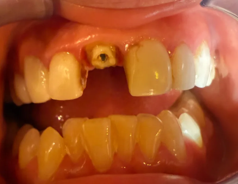 Before image