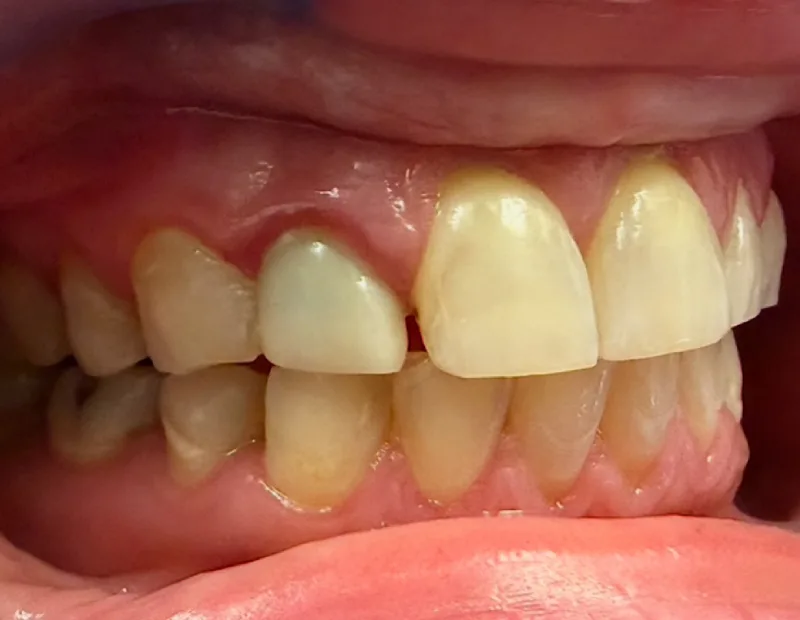 Before image