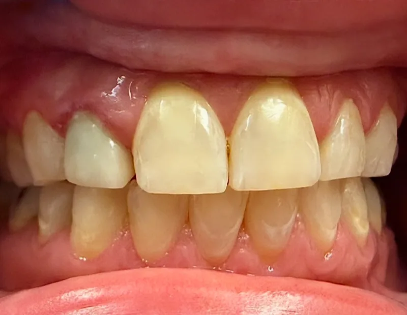 Before image